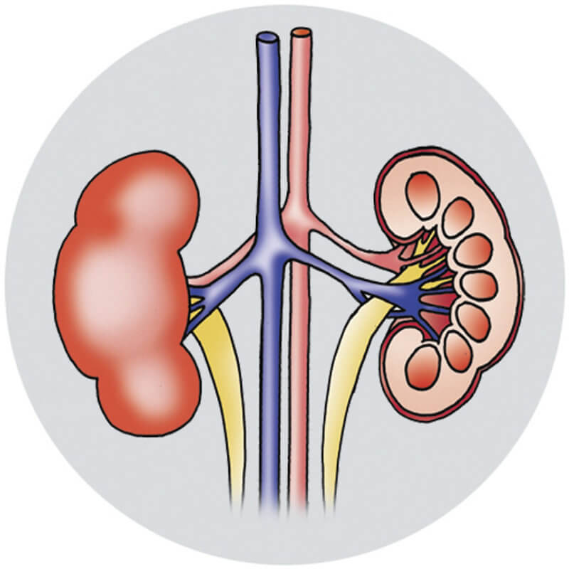 VSVZ84SI-zvisan-krvni-tlak-Krka-okvare-ledvic_c800x800